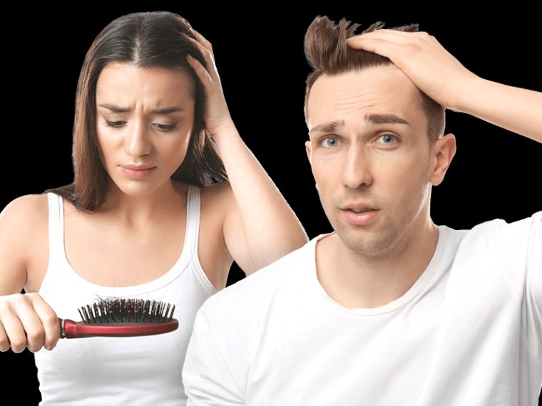 ¿La alopecia es más común en hombres o mujeres? - DermaMedic